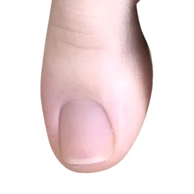 Toe Stubber