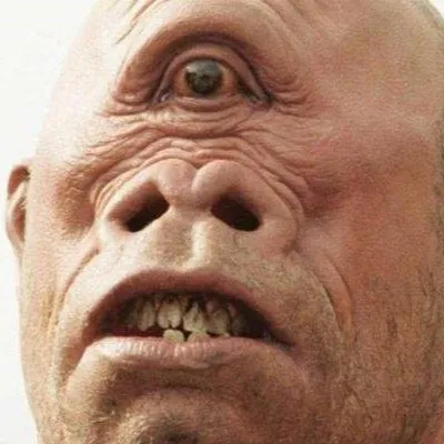 Cyclops