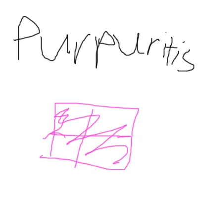 Purpuritis